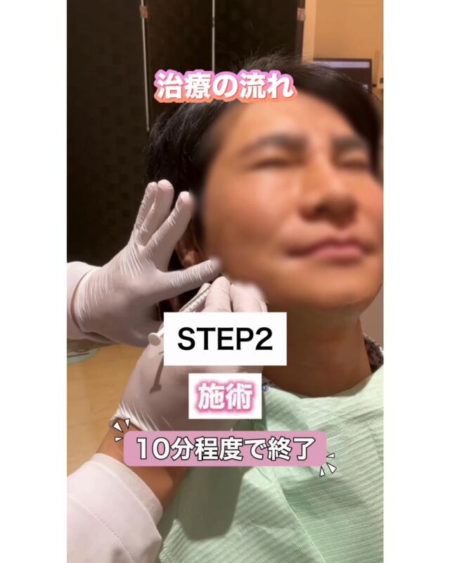 📣【朝の顎のだるさ・頭痛・肩こり…噛みしめが原因かも？】

朝起きた時に�「顎がだるい…」�「頭痛や肩こりがつらい…」�そんなお悩みはありませんか？💭
実はそれ、噛みしめ（食いしばり）が原因かもしれません。

今回の動画では、�咬筋ボトックスについて分かりやすく解説しています🦷✨
咬筋ボトックスとは、�噛む筋肉（咬筋）にボツリヌス注射を行い、�筋肉の緊張を一時的にゆるめる治療です💡

噛みしめで発達した咬筋の働きを抑えることで、�
✅ フェイスラインがすっきり見える�こともあります😊
さらに、噛みしめ由来の�
✅ 頭痛
✅ 肩こり
✅ 口が開けにくい�
などの症状が、緩和するケースも期待できます🌿

🦷治療の流れ�① カウンセリング・診察�噛みしめの癖や筋肉の状態を確認し、効果や注意点を丁寧にご説明します。�② 施術（約10分程度）�短時間で終わることが多く、ダウンタイムもほとんどありません✨�痛みはチクッと感じる程度が一般的です。

📌施術当日の注意点�・注射部位を強くこすらない／圧迫しない�・激しい運動、長時間の入浴、サウナは控えるのがおすすめです
効果は数日で感じ始めることが多く、�状態に合わせてメンテナンスもご提案します😊

💰咬筋ボトックス：1回 45,000円�まずは状態確認から、お気軽にご相談ください✨
――――――――――――――――�
📍山口県宇部市｜厚南ハピネス歯科�📞0836-43-6800�――――――――――――――――
#厚南ハピネス歯科 #咬筋ボトックス #食いしばり改善�#噛みしめ #顎のだるさ #頭痛改善 #肩こり改善�#フェイスライン #小顔効果 #宇部市歯医者 #山口県歯科