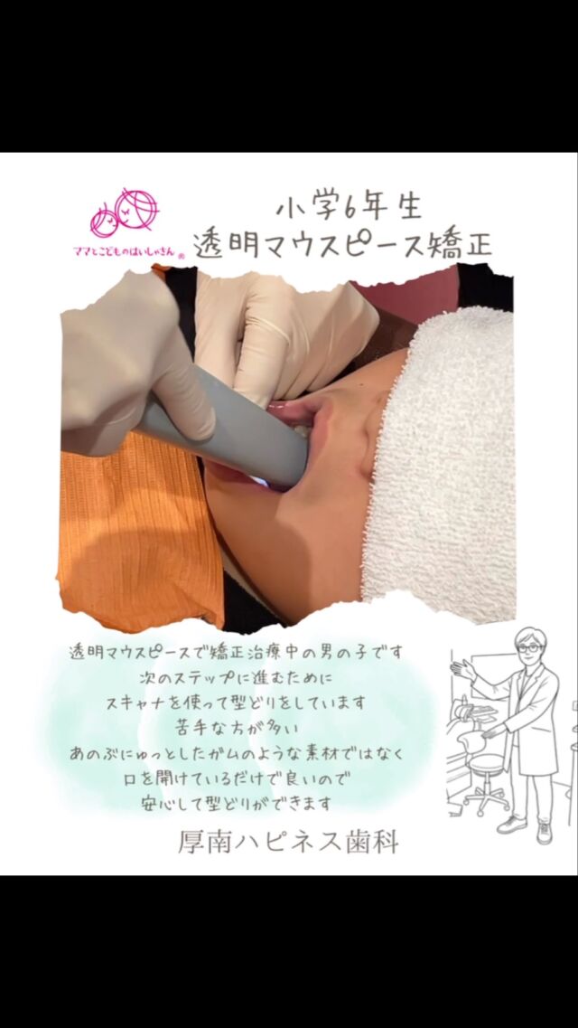🦷お口の中をスキャンするよ〜！

今日は歯医者さんでお口の中をチェック✨

カメラみたいな機械で、
歯を1本ずつ撮影していくよ📸🦷

すると…
お口の中の様子が画面に映し出されるんだって！😳✨

お口の中をカメラで撮るように、
歯の形や並び方を記録できるんだよ♪

ちょっと不思議だけど、おもしろいね〜！

こうやってお口の中を確認しながら、
マウスピース矯正を進めていくよ🌈

これからもがんばるぞ〜！💪

━━━━━━━━━━━━━━

🌸 厚南ハピネス歯科

📞 0836-43-6800

📍 山口県宇部市厚南北1-3-23
　際波グランフォート3号

🚗 駐車場あり

━━━━━━━━━━━━━━

#子どもの矯正
#マウスピース矯正
#口腔内スキャナー
#宇部市歯医者
#厚南ハピネス歯科